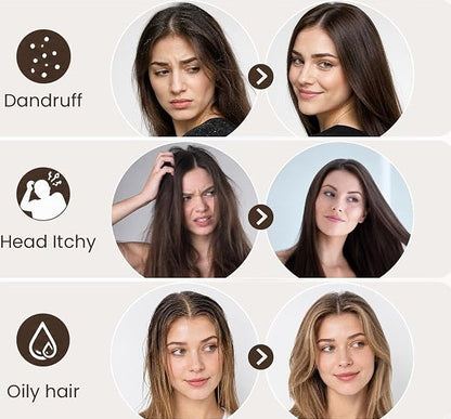 Detox Comb-Dandruff Scalp Hair Combs for Women/Men/Kids